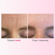 Lumé Face Tape - Колагенови Лепенки Против Бръчки