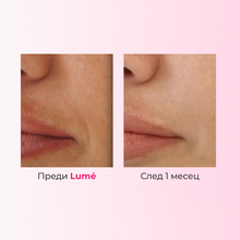 Lumé Face Tape - Колагенови Лепенки Против Бръчки