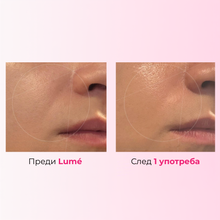 Lumé Face Tape - Колагенови Лепенки Против Бръчки